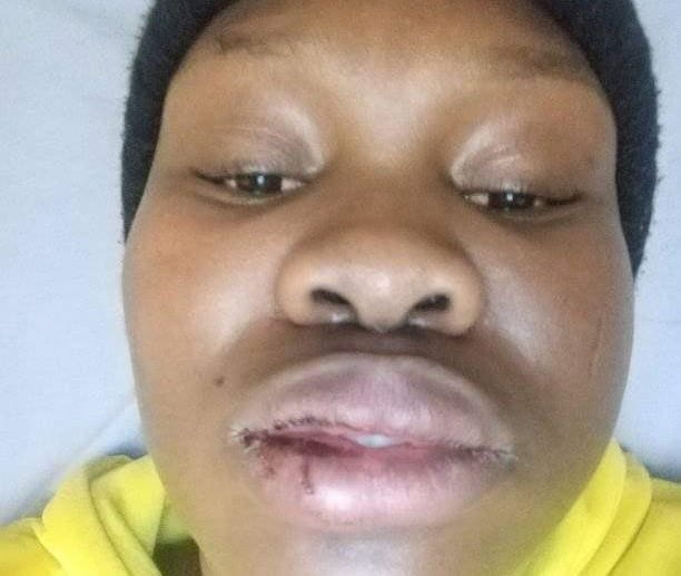 UMZIMVUBU: ANOTHER HIGH–PROFILE MAN ACCUSED OF PHYSICAL ABUSE UMZIMVUBU ANOTHER HIGH –PROFILE MAN ACCUSED OF PHYSICAL ABUSE