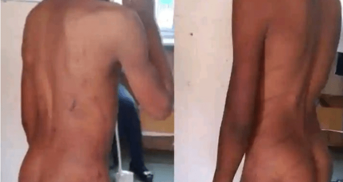 A Boy Beaten Up By Parents NINE YEARS BOY LEFT TRAUMATISED AFTER BEATINGS