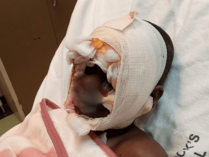 Maqongwana Secondary School Students Suffer Severe Burns While Performing School Chores