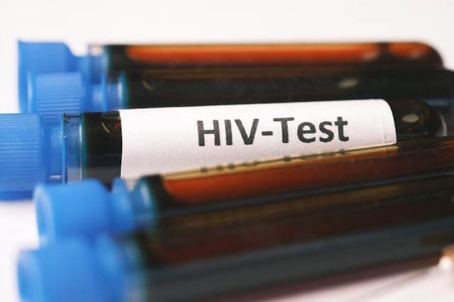 Pexels Towfiqu Barbhuiya 3440682 10963257 (1) DA Calls for Urgent Restoration of PEPFAR Funding to Prevent Health Crisis